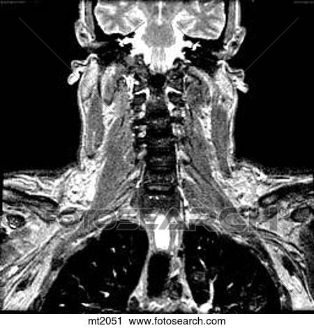Upper Body - Coronal View Large Illustration Clip Art - Upper Body - Coronal. Fotosearch