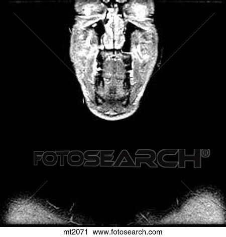 Upper Body - Coronal View Large Illustration Clip Art - Upper Body - Coronal. Fotosearch