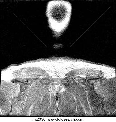 Upper Body - Coronal View Large Illustration Clipart - Upper Body - Coronal. Fotosearch