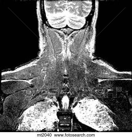 Upper Body - Coronal View Large Illustration Clipart - Upper Body - Coronal. Fotosearch