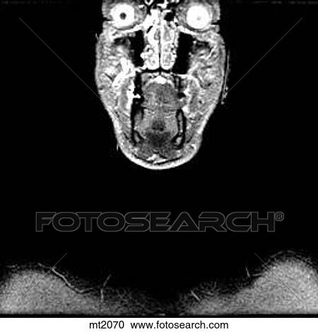 Upper Body - Coronal View Large Illustration Clipart - Upper Body - Coronal. Fotosearch