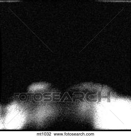 Upper Body - Coronal View Large Illustration Drawing - Upper Body - Coronal. Fotosearch