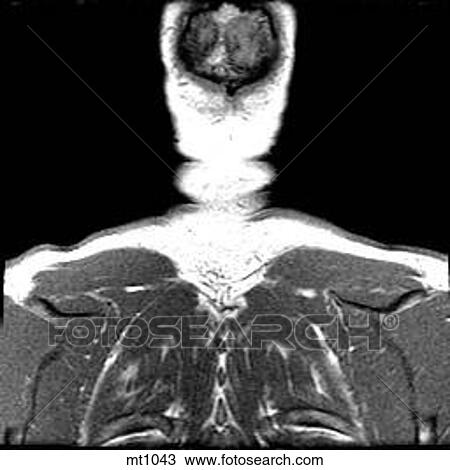 Drawing - Upper Body - Coronal. Fotosearch
