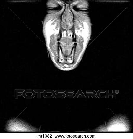 Upper Body - Coronal View Large Illustration Drawing - Upper Body - Coronal. Fotosearch