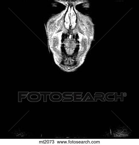 Upper Body - Coronal View Large Illustration Drawing - Upper Body - Coronal. Fotosearch