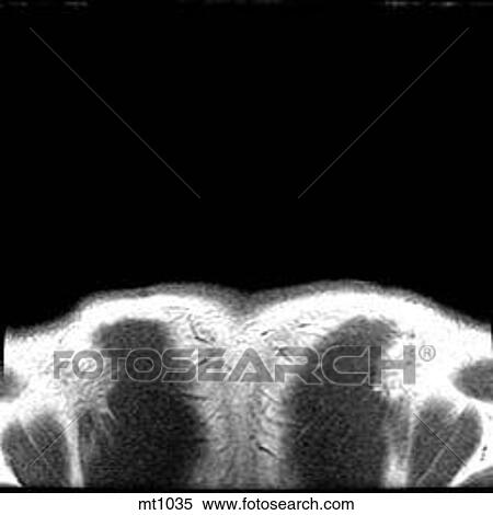 Upper Body - Coronal View Large Illustration Stock Illustration - Upper Body - Coronal. Fotosearch