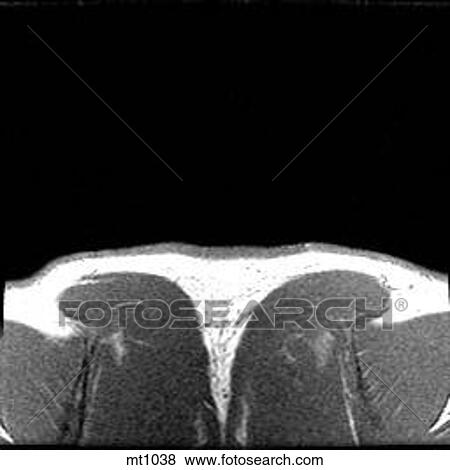 Upper Body - Coronal View Large Illustration Stock Illustration - Upper Body - Coronal. Fotosearch