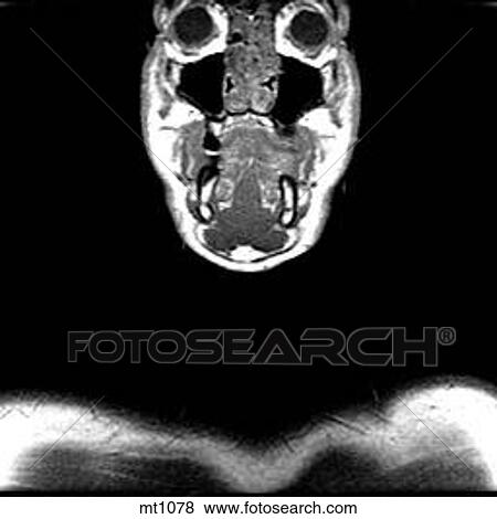 Upper Body - Coronal View Large Illustration Stock Illustration - Upper Body - Coronal. Fotosearch