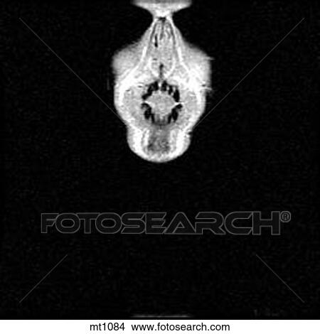Upper Body - Coronal View Large Illustration Stock Illustration - Upper Body - Coronal. Fotosearch