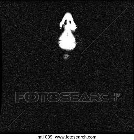 Stock Illustration - Upper Body - Coronal. Fotosearch
