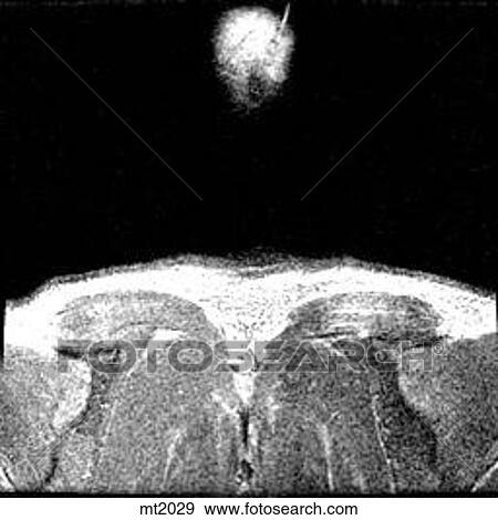 Stock Illustration - Upper Body - Coronal. Fotosearch