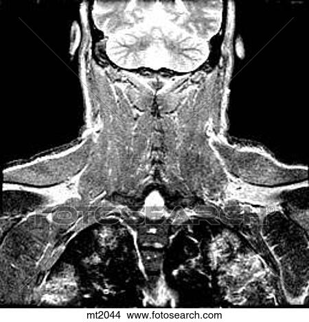 Upper Body - Coronal View Large Illustration Stock Illustration - Upper Body - Coronal. Fotosearch