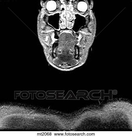 Upper Body - Coronal View Large Illustration Stock Illustration - Upper Body - Coronal. Fotosearch