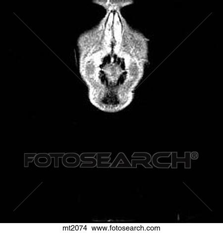 Upper Body - Coronal View Large Illustration Stock Illustration - Upper Body - Coronal. Fotosearch