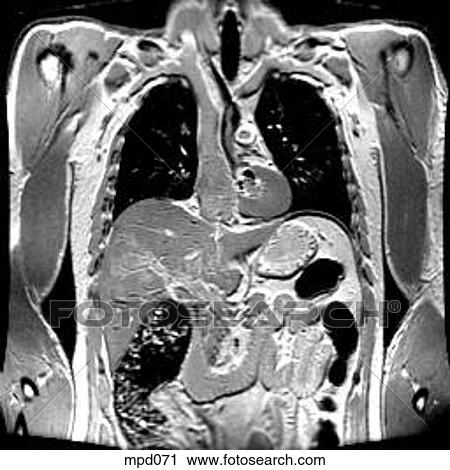 Upper Torso - Coronal View Large Illustration Clip Art - Upper Torso - Coronal. Fotosearch