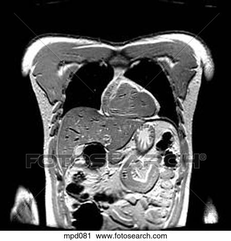 Upper Torso - Coronal View Large Illustration Clip Art - Upper Torso - Coronal. Fotosearch