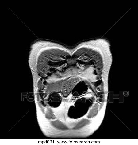 Upper Torso - Coronal View Large Illustration Clip Art - Upper Torso - Coronal. Fotosearch