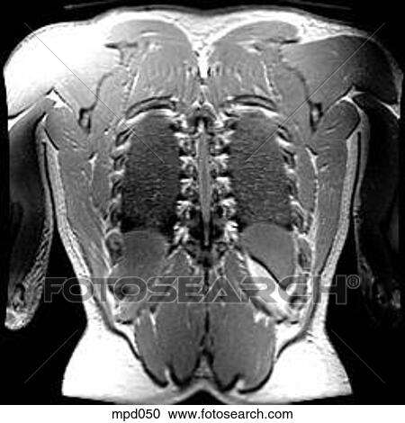 Upper Torso - Coronal View Large Illustration Clipart - Upper Torso - Coronal. Fotosearch