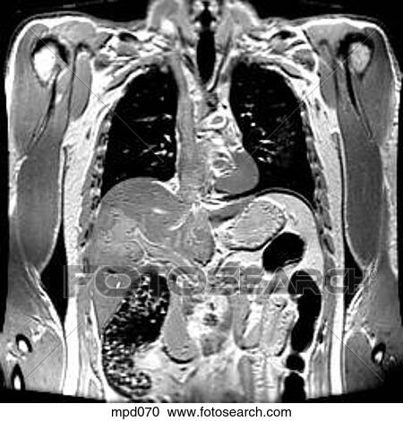 Upper Torso - Coronal View Large Illustration Clipart - Upper Torso - Coronal. Fotosearch