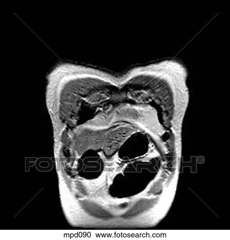 Clipart - Upper Torso - Coronal. Fotosearch