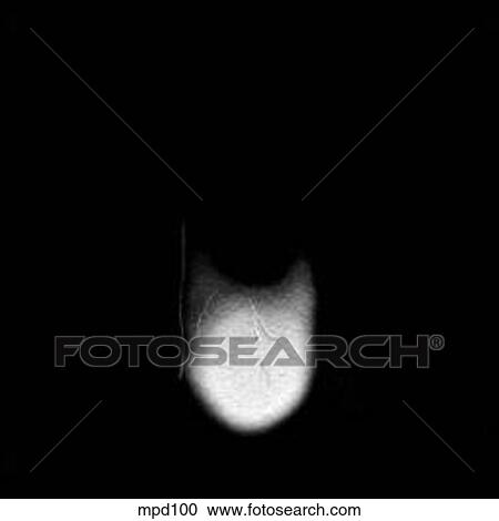 Upper Torso - Coronal View Large Illustration Clipart - Upper Torso - Coronal. Fotosearch