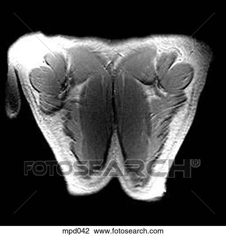 Upper Torso - Coronal View Large Illustration Drawing - Upper Torso - Coronal. Fotosearch