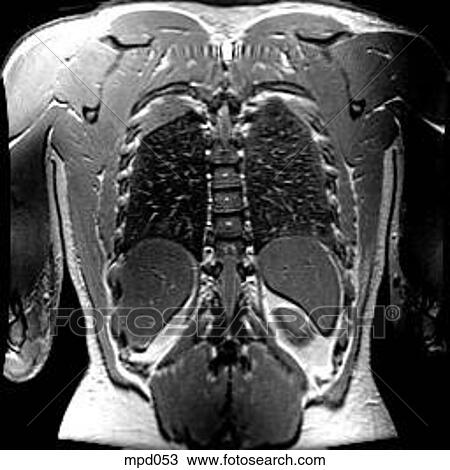 Upper Torso - Coronal View Large Illustration Drawing - Upper Torso - Coronal. Fotosearch