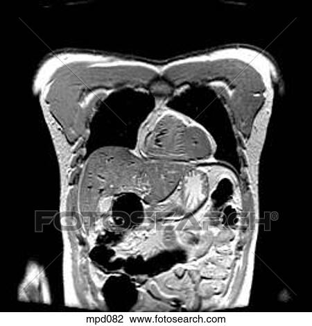 Upper Torso - Coronal View Large Illustration Drawing - Upper Torso - Coronal. Fotosearch