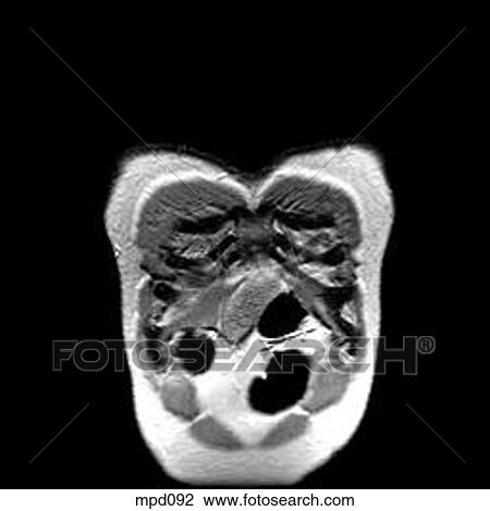 Upper Torso - Coronal View Large Illustration Drawing - Upper Torso - Coronal. Fotosearch