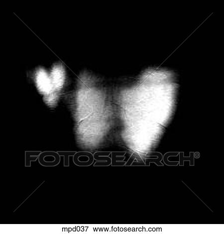 Upper Torso - Coronal View Large Illustration Stock Illustration - Upper Torso - Coronal. Fotosearch