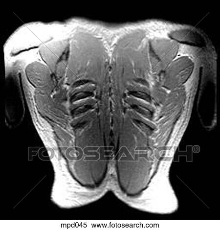Upper Torso - Coronal View Large Illustration Stock Illustration - Upper Torso - Coronal. Fotosearch