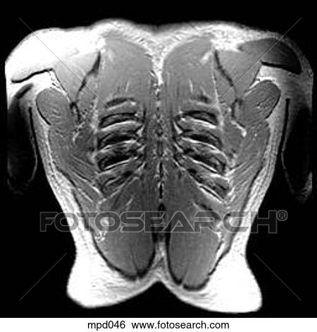 Upper Torso - Coronal View Large Illustration Stock Illustration - Upper Torso - Coronal. Fotosearch