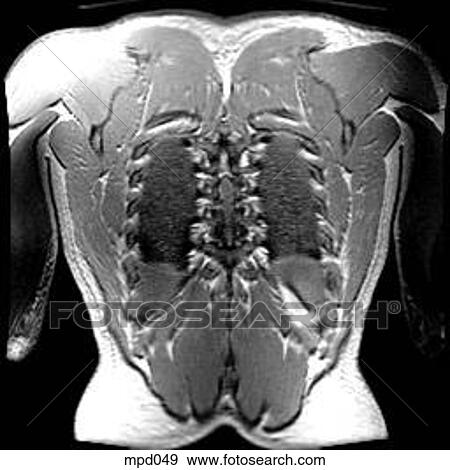 Upper Torso - Coronal View Large Illustration Stock Illustration - Upper Torso - Coronal. Fotosearch