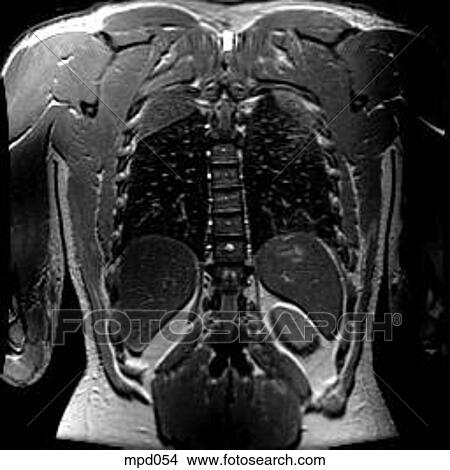 Upper Torso - Coronal View Large Illustration Stock Illustration - Upper Torso - Coronal. Fotosearch