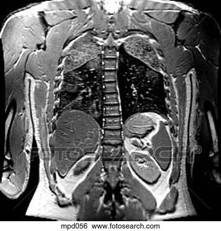 Upper Torso - Coronal View Large Illustration Stock Illustration - Upper Torso - Coronal. Fotosearch