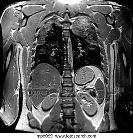 Upper Torso - Coronal View Large Illustration Stock Illustration - Upper Torso - Coronal. Fotosearch