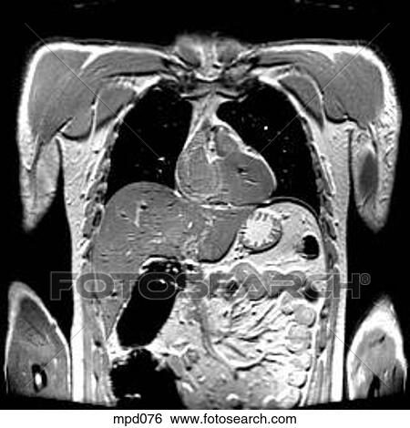 Upper Torso - Coronal View Large Illustration Stock Illustration - Upper Torso - Coronal. Fotosearch
