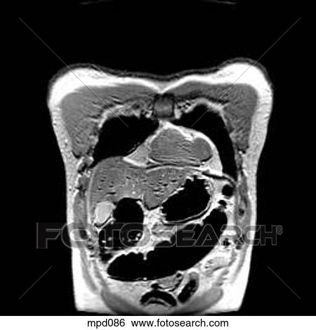 Upper Torso - Coronal View Large Illustration Stock Illustration - Upper Torso - Coronal. Fotosearch