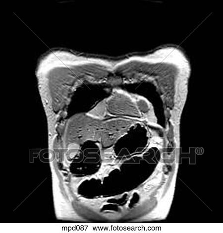 Upper Torso - Coronal View Large Illustration Stock Illustration - Upper Torso - Coronal. Fotosearch
