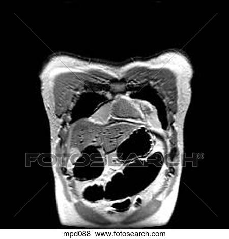 Upper Torso - Coronal View Large Illustration Stock Illustration - Upper Torso - Coronal. Fotosearch