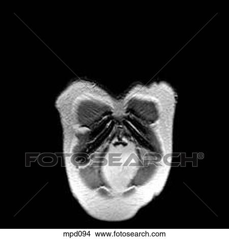 Stock Illustration - Upper Torso - Coronal. Fotosearch