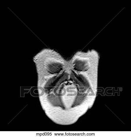 Upper Torso - Coronal View Large Illustration Stock Illustration - Upper Torso - Coronal. Fotosearch