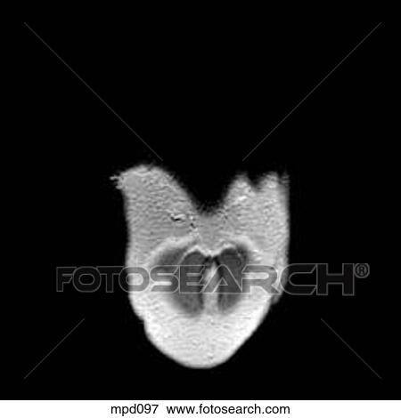 Upper Torso - Coronal View Large Illustration Stock Illustration - Upper Torso - Coronal. Fotosearch