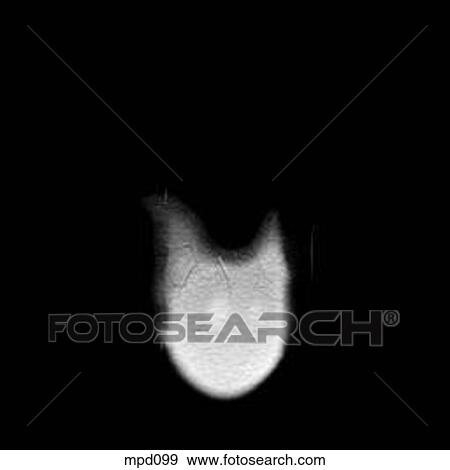 Upper Torso - Coronal View Large Illustration Stock Illustration - Upper Torso - Coronal. Fotosearch