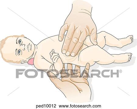 横の視野 の 仰向け 幼児 提示 技術 ために Bimanual Palpation の Kidney スケッチ Ped Fotosearch