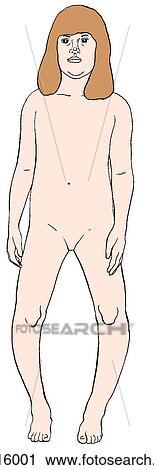 Anterior view of young girl illustrating bowed legs or genu varum. View Large Illustration Clip Art - Anterior view of young girl illustrating bowed legs or genu varum.. Fotosearch