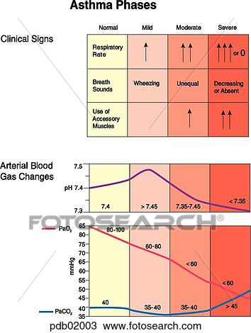 Chart showing correlation of clinical signs and arterial blood gas changes in mild, moderate, and severe asthma compared to normal. View Large Illustration Drawing - Chart showing correlation of clinical signs and arterial blood gas changes in mild, moderate, and severe asthma compared to normal.. Fotosearch