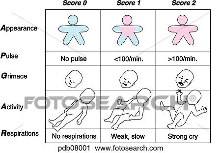 Clip Art - Chart showing evaluation of newborn's physical status.. Fotosearch