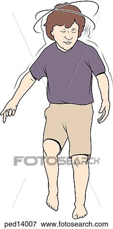 Child staggering in a state of dizziness. View Large Illustration Stock Illustration - Child staggering in a state of dizziness.. Fotosearch