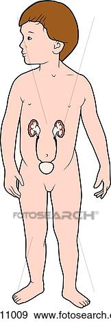 Child suffering from hydronephrosis standing with kidneys and bladder visible. View Large Illustration Stock Illustration - Child suffering from hydronephrosis standing with kidneys and bladder visible.. Fotosearch